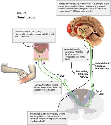 Itch: from the skin to the brain – peripheral and central neural sensitization in chronic itch